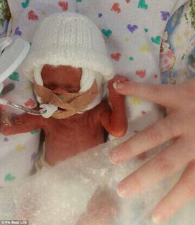 "Это чудо": близнецы родились на сроке 25 недель и выжили