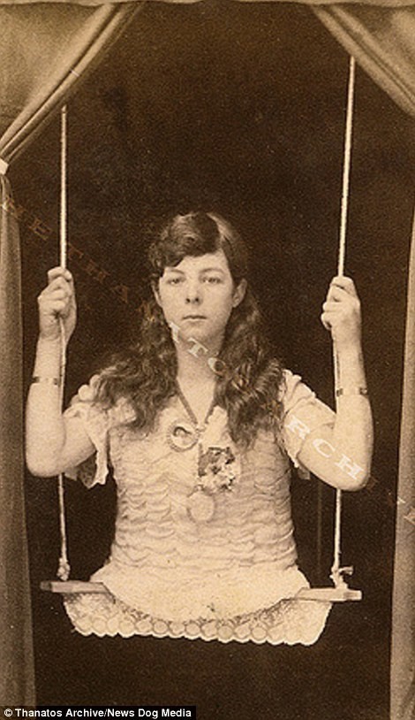 Девочка без ног, 1880-е годы