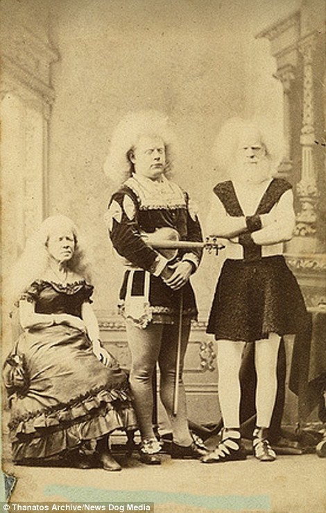 Члены семьи альбиносов Лукази были знаменитыми артистами в XIX веке