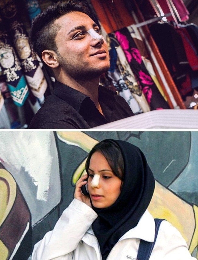 Хирургические повязки на лице Иран