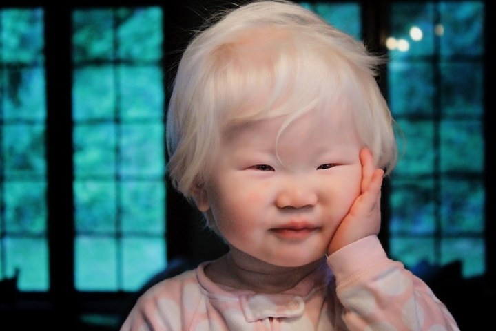 Малыш азиат-альбинос