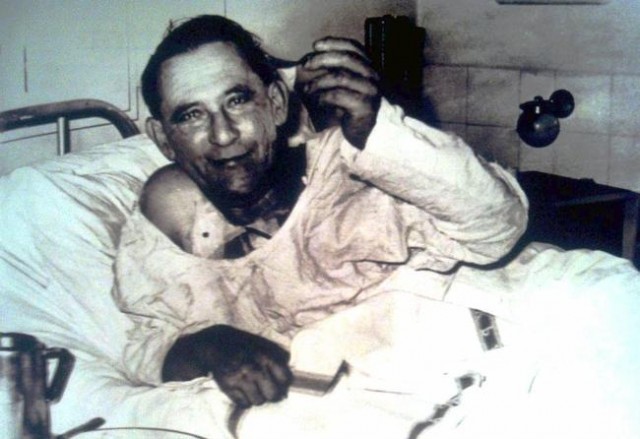 Человек, первым успешно прошедший пересадку сердца – Луис Вашкански. Больница Грут Щур, Кейптаун, 6 декабря 1967 года – третий день после операции.
