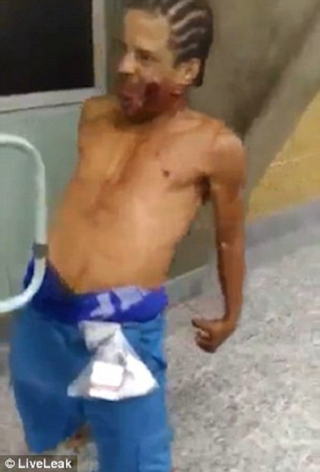 Жуткое происшествие в бразильском госпитале: раненый или одержимый?