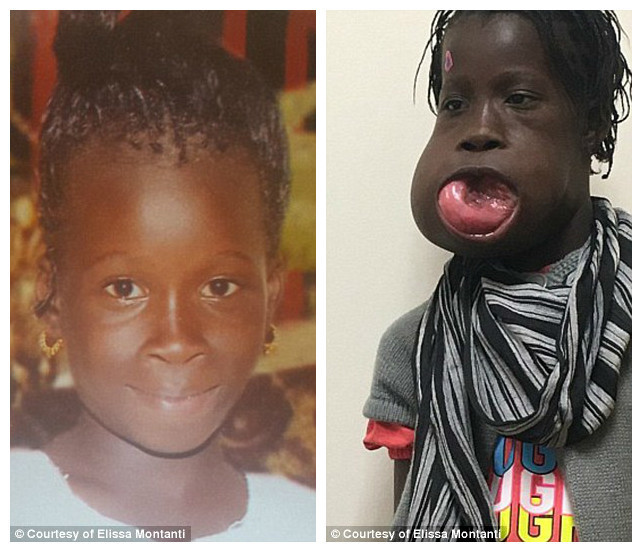Впервые девочка пожаловалась на боль, когда ей было девять. Мама обращалась к врачам в Гамбии и Сенегале, но безрезультатно
