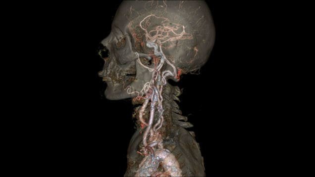 Так выглядит снимок головы человека, сделанный новейшим компьютерным томографом