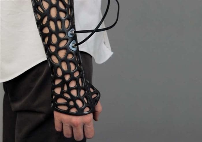 Замена гипсу: этот фиксирующий "корсет", напечатанный на 3D-принтере, использует ультразвук, благодаря которому кости заживают на 38% быстрее