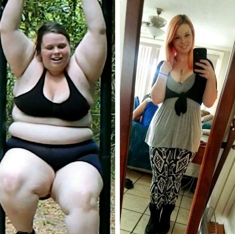 За 2 года ей удалось сбросить 87,5 кг, чем она поспешила поделиться с пользователями сайта Imgur  