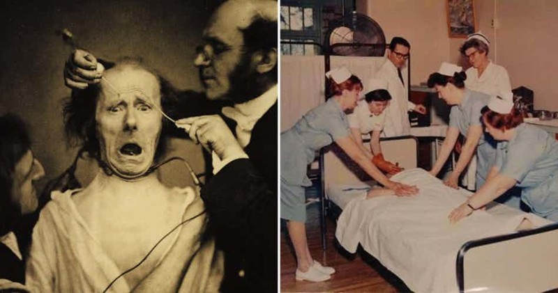 15 жутких вещей, которые были позволены врачам прошлого