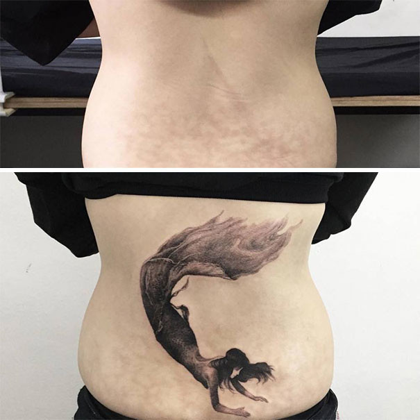 Татуировки, превратившие шрамы в произведения искусства