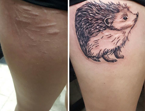 Татуировки, превратившие шрамы в произведения искусства
