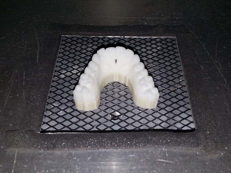 Парень создал с помощью 3D-принтера пластиковые брекеты, чтобы выровнять свои собственные зубы