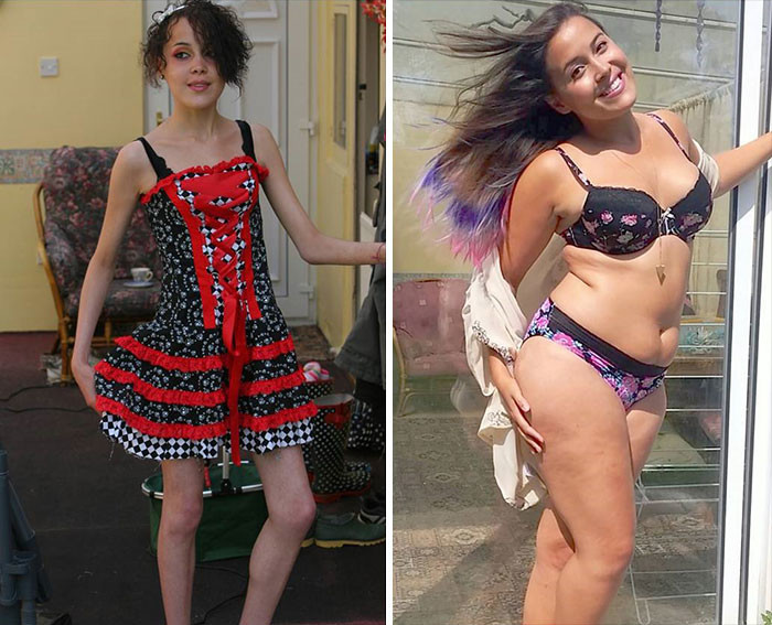 Меган Джейн Крабби в 13 лет весила 28 килограммов. С тех пор она многое переосмыслила, а главное — восстановилась и больше не боится выглядеть неидеально