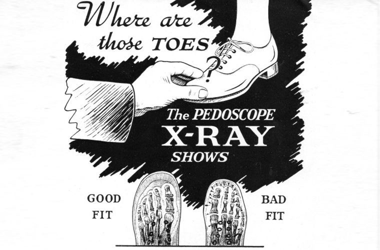 Зачем в первой половине XX века во время примерки обуви ноги просвечивали рентгеном