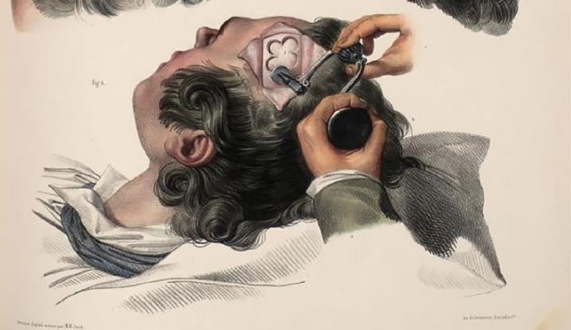 Шокирующие иллюстрации из руководства по хирургии XIX века