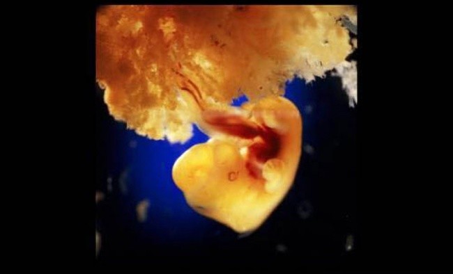 6 недель развития. Наружные клетки зародыша присоединиться к свободной поверхности стенки матки, образуя плаценту, через которую плод получает все питательные вещества.Спустя 8 недель после зачатия.