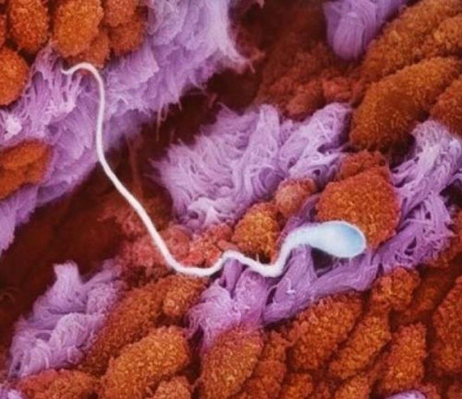 Сперматозоид движется по маточной трубе в сторону яйцеклетки, чтобы оплодотворить ее.