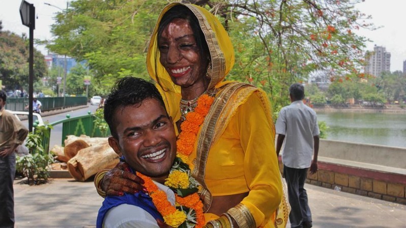 Жертва кислотной атаки из Индии нашла мужа по случайному звонку