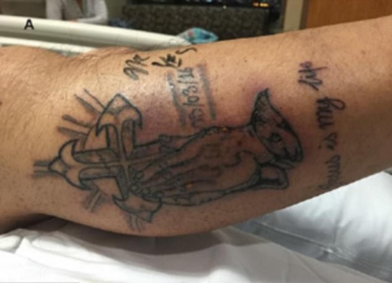 31-летний мужчина нанес на правую икру татуировки с религиозным крестом. Он решил не ждать две недели, и уже через 5 дней отправился поплавать в водах Мексиканского залива.