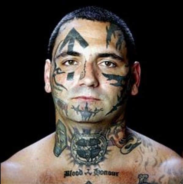 Бывший нацист сделал 25 операций, чтобы избавиться от расистских татуировок