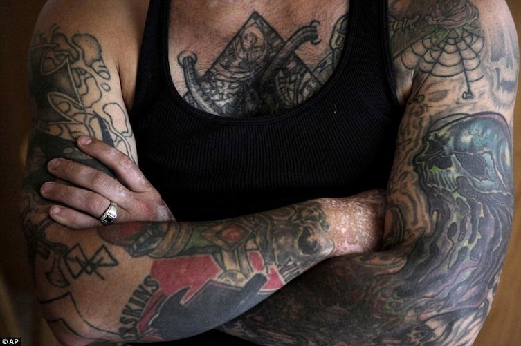 Бывший нацист сделал 25 операций, чтобы избавиться от расистских татуировок