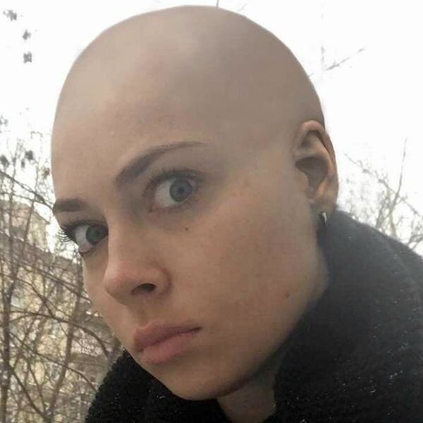 Красивые лысые девушки