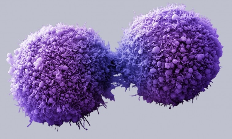 Каждую минуту ваше тело производит раковые клетки. Однако их появление не приводит к раку, потому что ваша иммунная система разрушает их