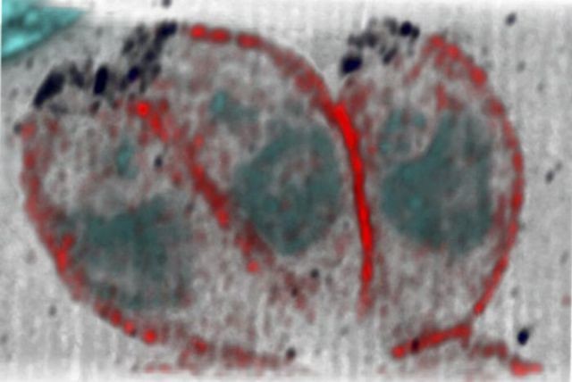 Паразиты Toxoplasma gondii