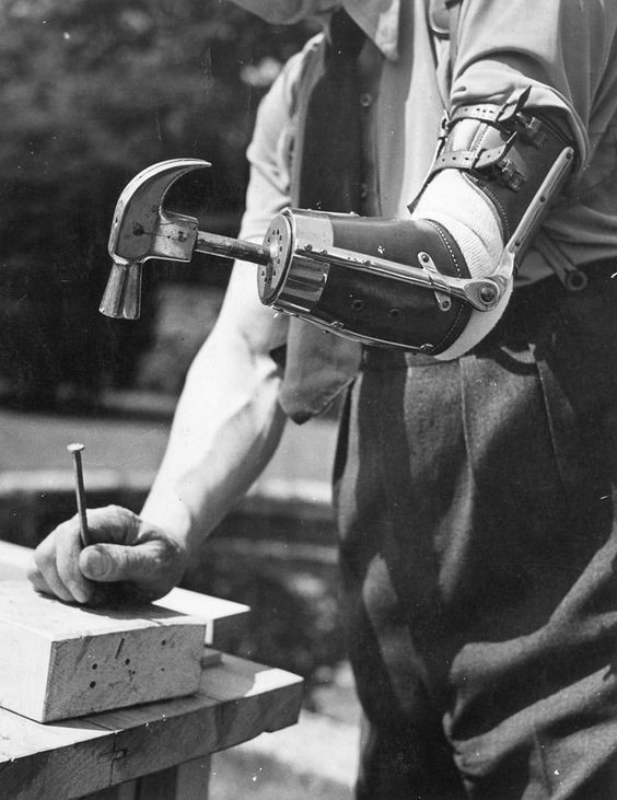 Большинство протезов выполнялись так, чтобы их основная функция оставалась рабочей. например рыцарям делали пальцы так, чтобы они могли держать щит, а рабочим ставили крюки и захваты, помогающие в процесс их работы
