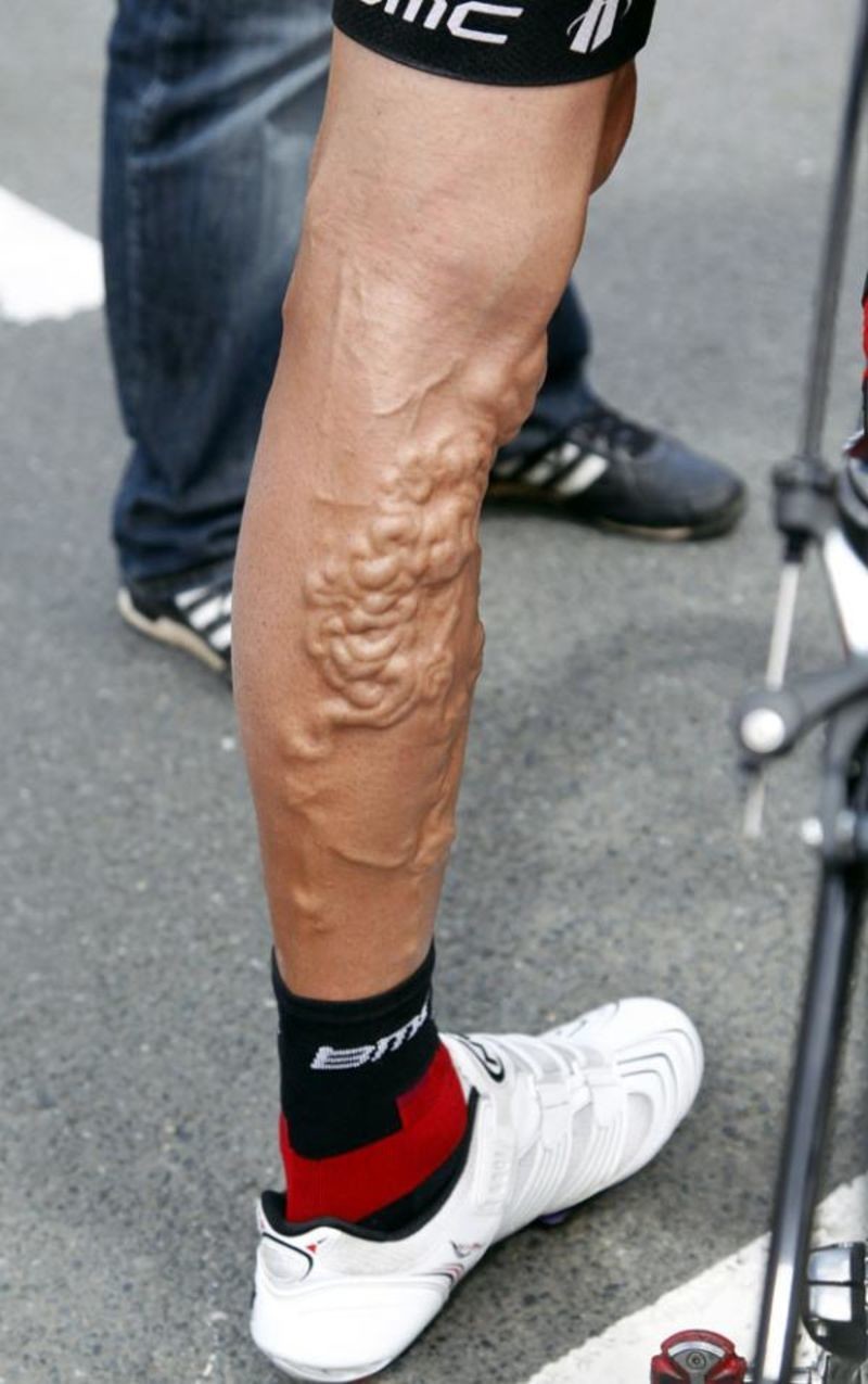 Велосипедисты шокируют видом своих ног! Этот пост лучше не смотреть тем, кто боится варикоза