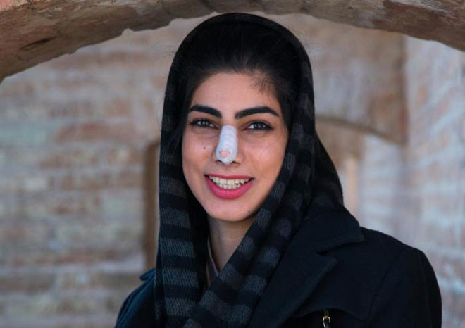 Хирургические повязки на лице, Иран