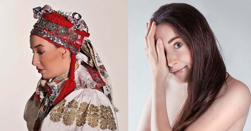 Впечатляющие селфи девушки из Словакии, родившейся с половиной лица