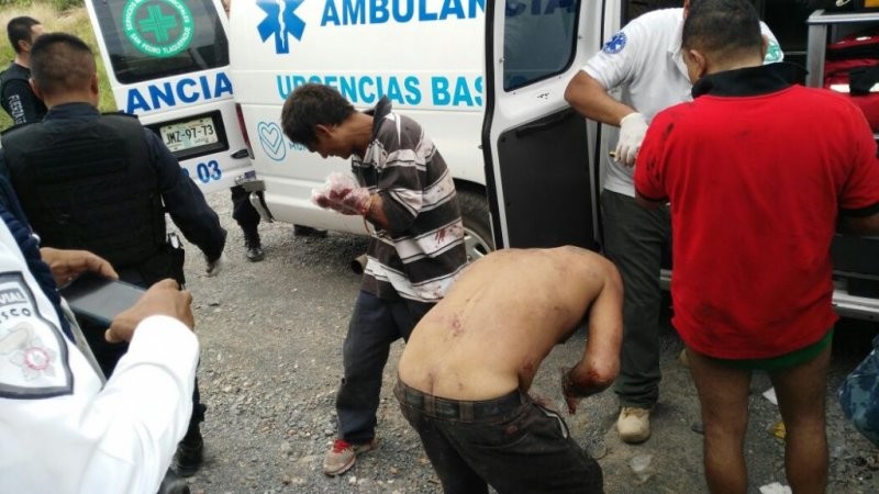 В Мексике уличным ворам отрубили руки