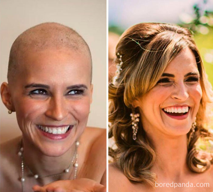 2 года разницы. Слева - во время курса химиотерапии, справа - на собственной свадьбе.