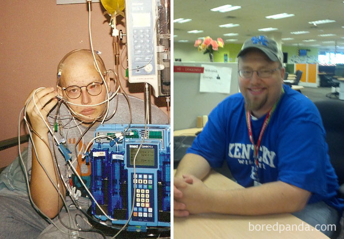 Лимфома Беркитта 4 стадии. "По прогнозам, я должен был умереть. Мы с родителями решились на экспериментальную химиотерапию. Сработало! 14 лет без рака"