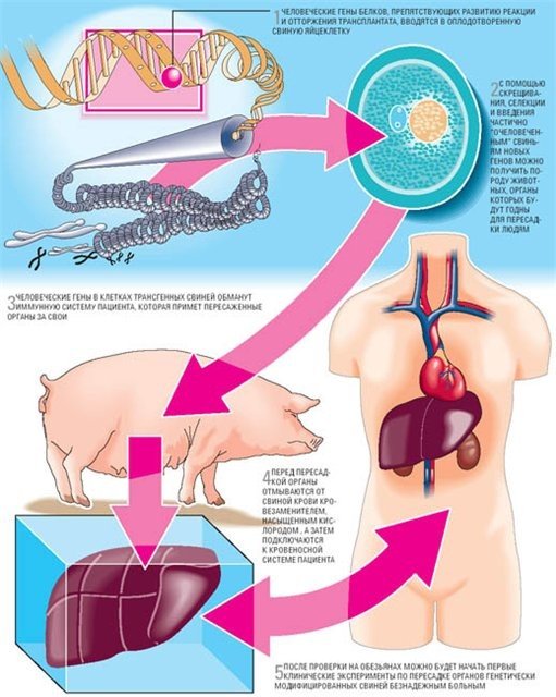 Трансплантация человеку внутренних органов свиней: преодолен последний барьер