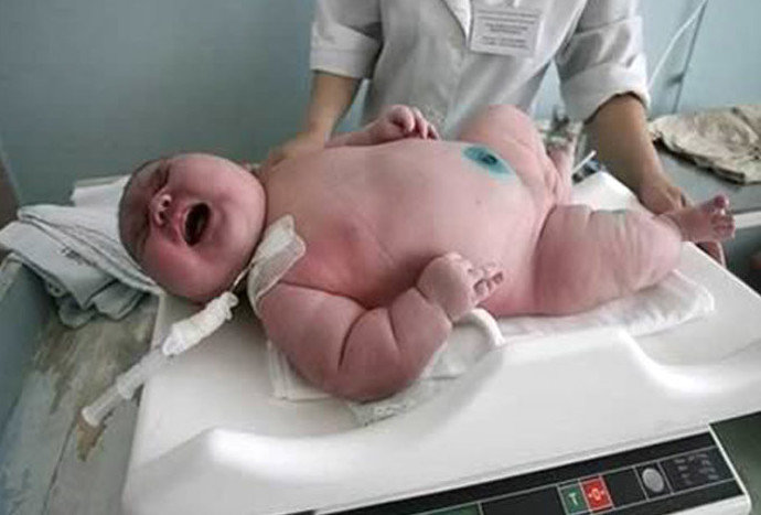 Самый крупный ребенок Бразилии - Адемильтон дос Сантос, 8 кг