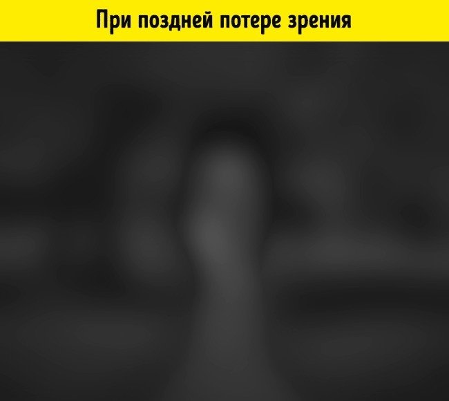 Эту картину увидят те, у кого сохранилось частичное светоощущение: они могут различать свет и темноту. Обычно это люди, которые потеряли зрение уже в осознанном возрасте.