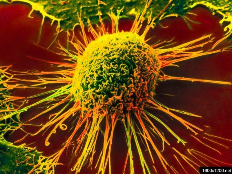 Новая технология распознает рак за 10 секунд