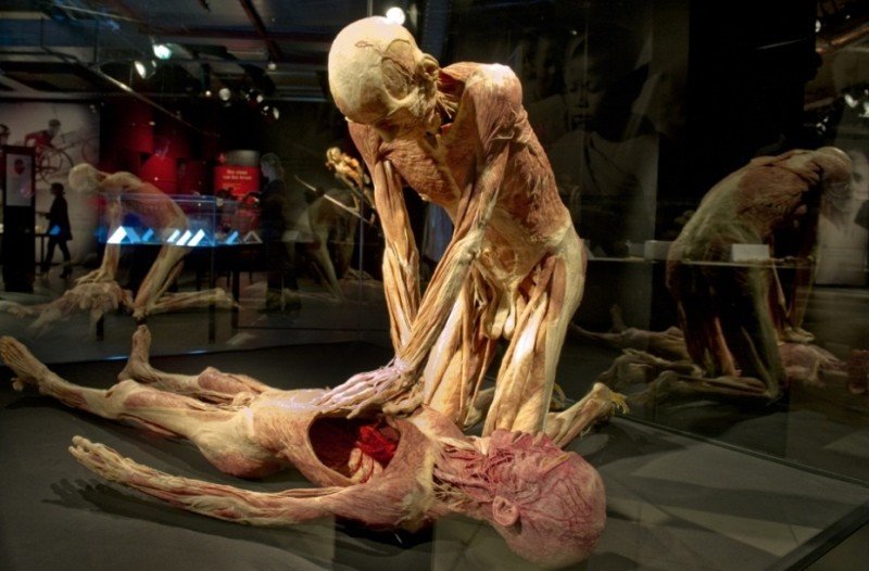 Части тела: приедет ли скандальная выставка Body Worlds в Россию