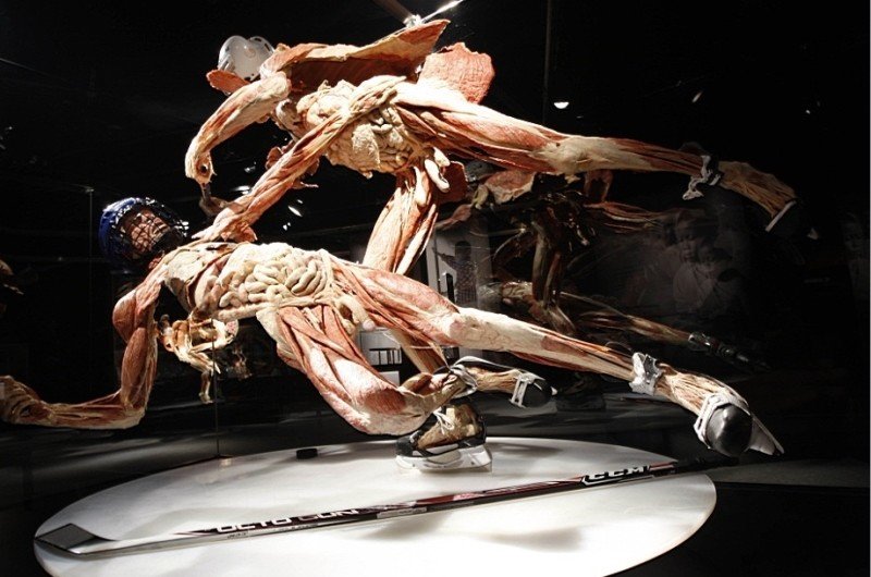 Части тела: приедет ли скандальная выставка Body Worlds в Россию