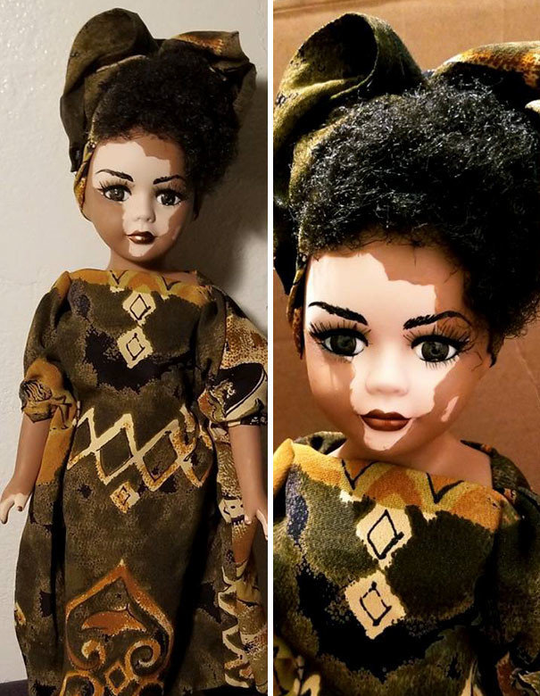 Художница создает куклы с витилиго для детей с редким кожным заболеванием