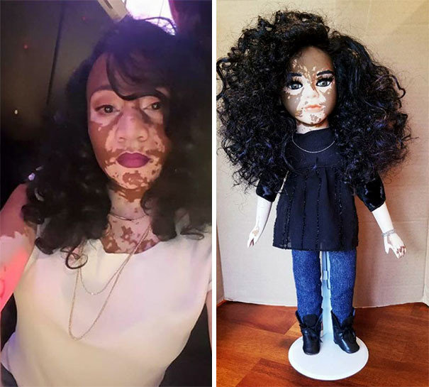 Художница создает куклы с витилиго для детей с редким кожным заболеванием
