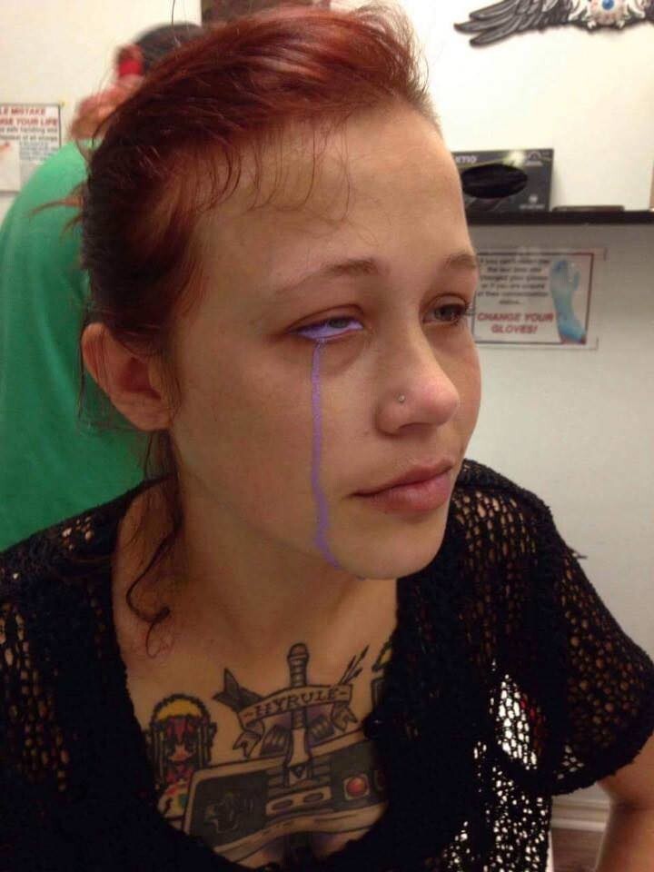 После процедуры из глаза девушки начал вытекать фиолетовый пигмент, веко опухло, появились боли 