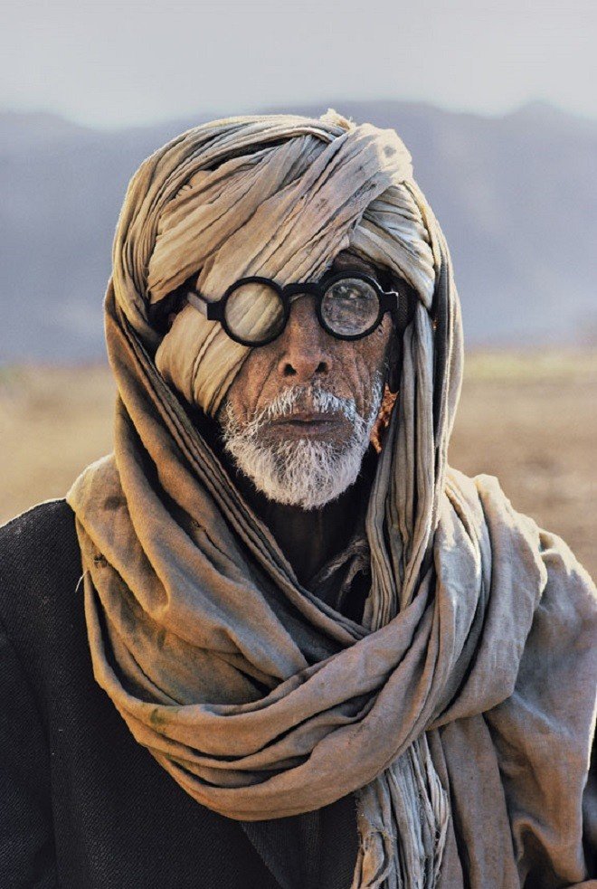 Афганский беженец с поврежденным глазом. Белуджистан, 1981 год