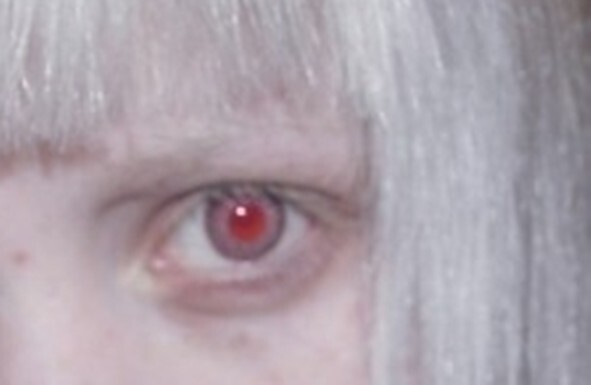 Какого цвета глаза у людей альбиносов? фотографии глаз альбиноса. Миф или правда?