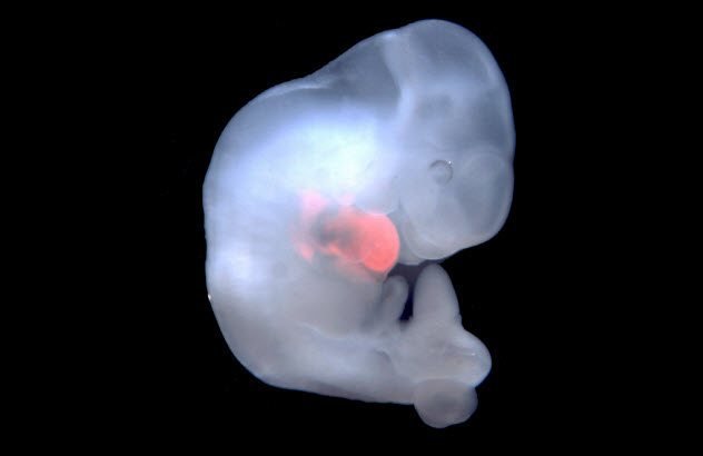 Человеко-свиной эмбрион