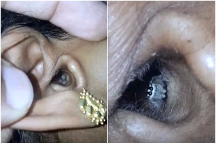 У женщины из Индии в ухе застрял паук. Но он выбрался и рад вас видеть