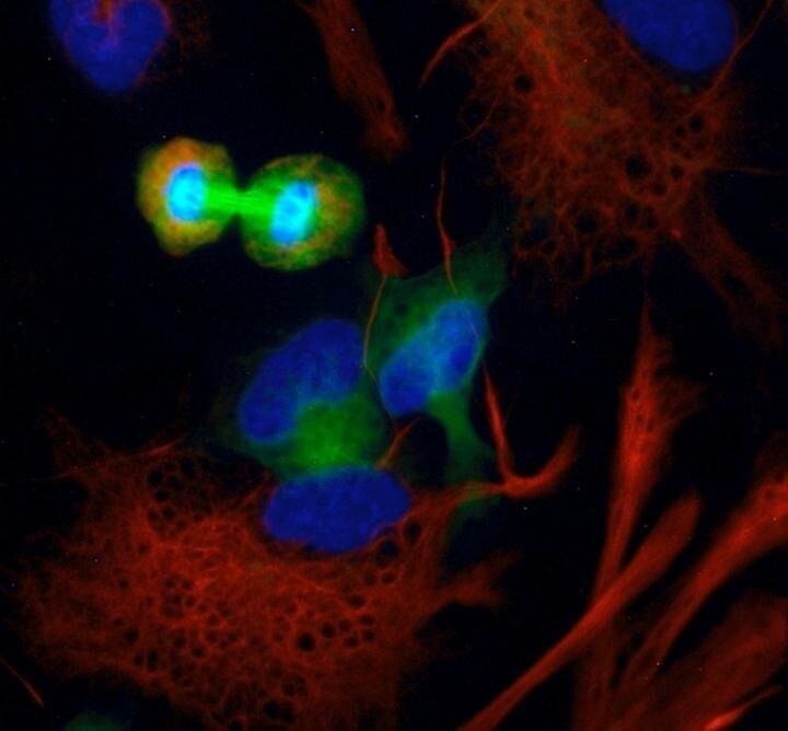 Делящиеся нейрональные стволовые клетки