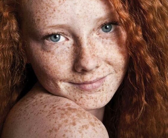 ДНК рыжеволосых людей наиболее чувствительна к солнечным ожогам и раку кожи, но с годами такой дефект может исчезнуть, если ясные дни и температура увеличатся, а хмурых дней будет меньше  
