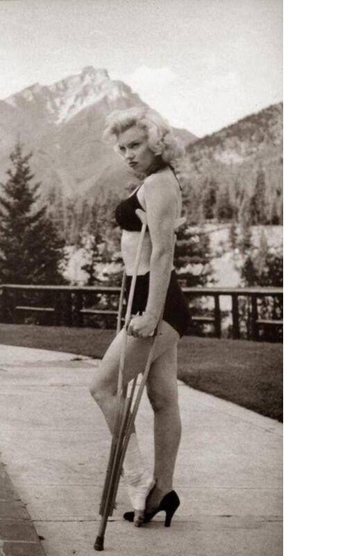 Мэрилин Монро со сломанной ногой. 1954 